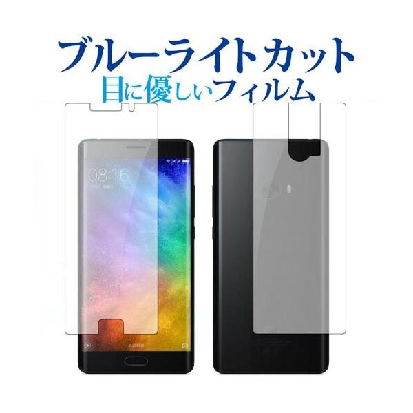 Xiaomi Mi Note 2 ʃZbg/xiaomip u[CgJbg ˖h~ t ی tB wh~ ݊i