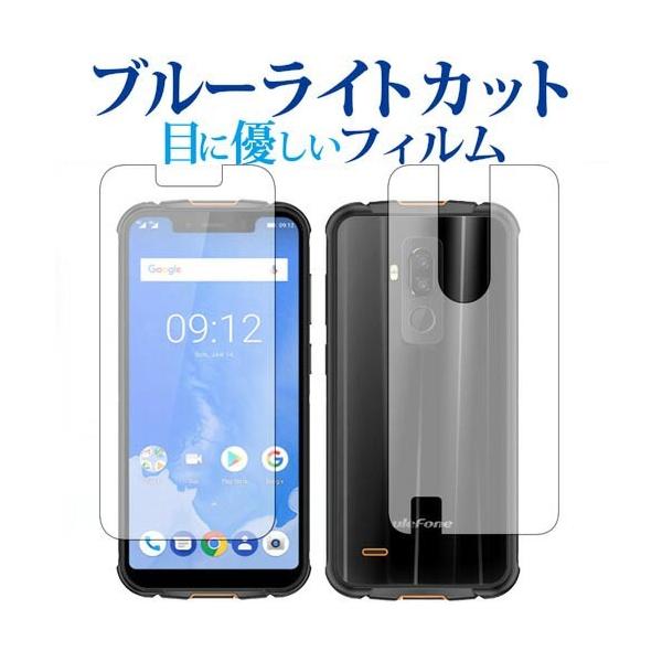 Ulefone Armor 5 ���ʃZ�b�g��p �u���[���C�g�J�b�g ���˖h�~ �t�� �ی� �t�B���� �w��h�~ �݊��i