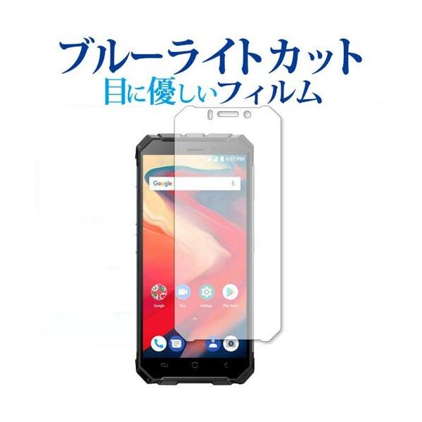 Ulefone Armor X2 ��p �u���[���C�g�J�b�g ���˖h�~ �t�� �ی� �t�B���� �w��h�~ �݊��i