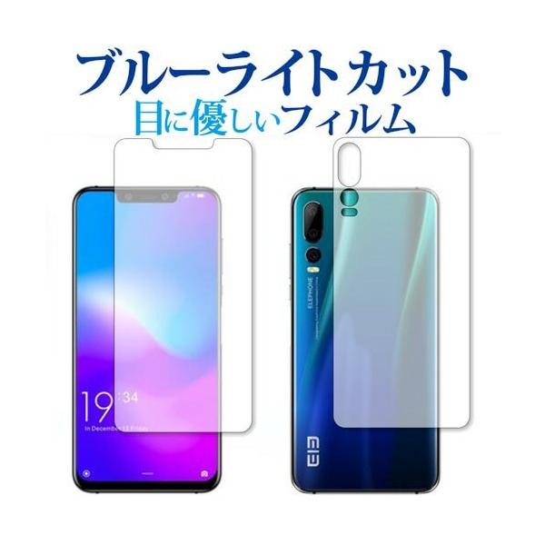 Elephone A5 ʃZbgp u[CgJbg ˖h~ t ی tB wh~ ݊i