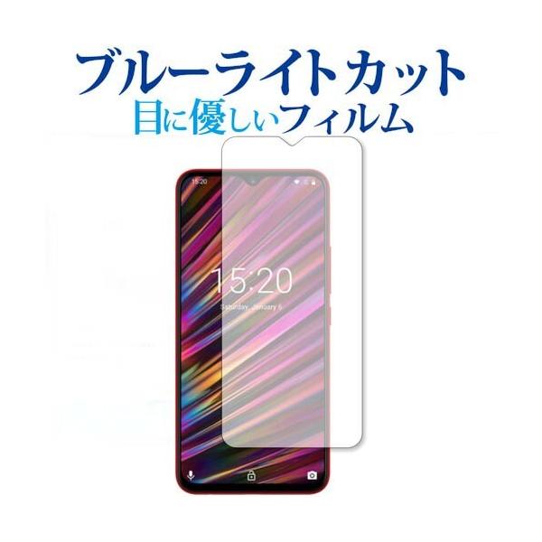 UMIDIGI F1p u[CgJbg ˖h~ t ی tB wh~ ݊i