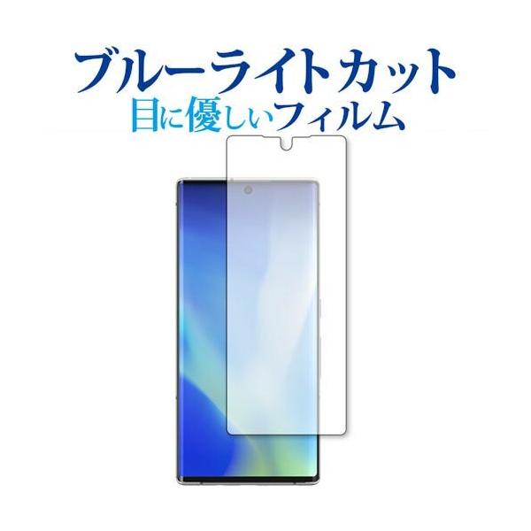 xm arrows NX9 p u[CgJbg ˖h~ ی tB wh~  [֑ ݊i