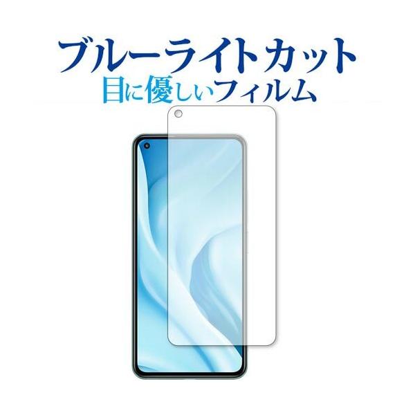 Xiaomi Mi 11 Lite 5G p u[CgJbg ˖h~ یtB wh~ ttB [֑ ݊i