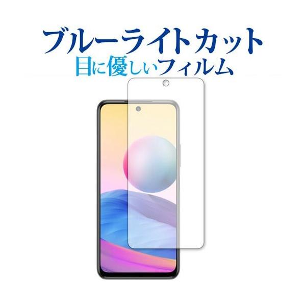 Redmi Note 10 JE ی tB u[CgJbg ˖h~ یtB wh~ [֑ ݊i