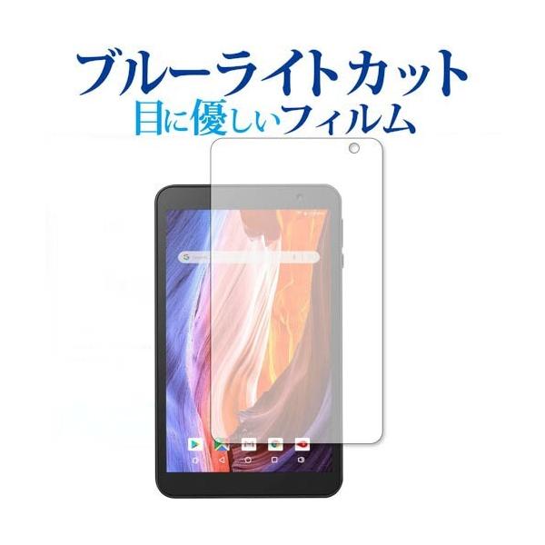 VANKYO MatrixPad S7 ��p �u���[���C�g�J�b�g ���˖h�~ �ی� �t�B���� �w��h�~  ���[���֑������� �݊��i