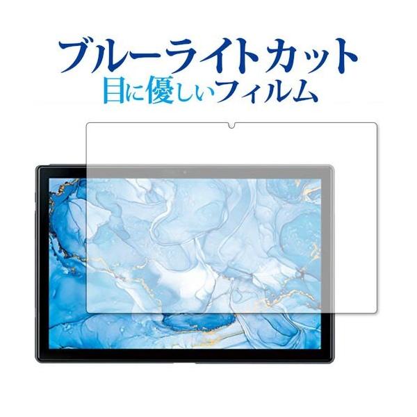 Dragon Touch NotePad 102 ��p �u���[���C�g�J�b�g ���˖h�~ �ی� �t�B���� �w��h�~  ���[���֑������� �݊��i