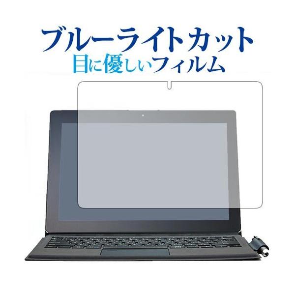 Diginnos DGM-S12Y�V���[�Y / �h�X�p����p �u���[���C�g�J�b�g ���˖h�~ �t�� �ی� �t�B���� �w��h�~ �݊��i