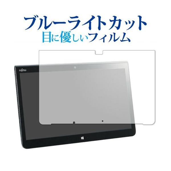 ARROWS Tab Q775 K p u[CgJbg ˖h~ یtB wh~ ttB [֑ ݊i