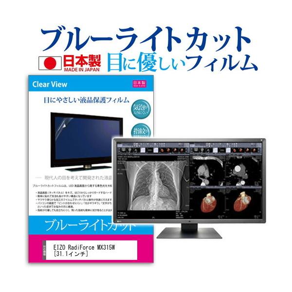 EIZO RadiForce MX315W �u���[���C�g�J�b�g ���˖h�~ �t�� �ی� �t�B���� �w��h�~ �C�A���X���H �݊��i