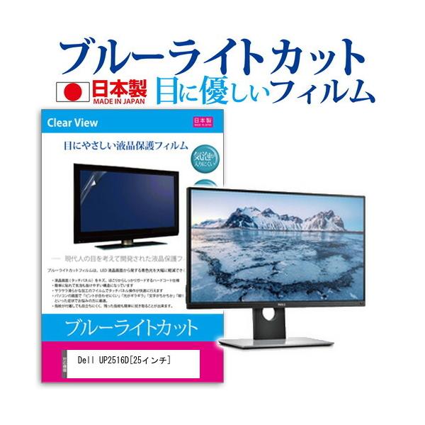 Dell UP2516D u[CgJbg ˖h~ t ی tB wh~ CAXH ݊i