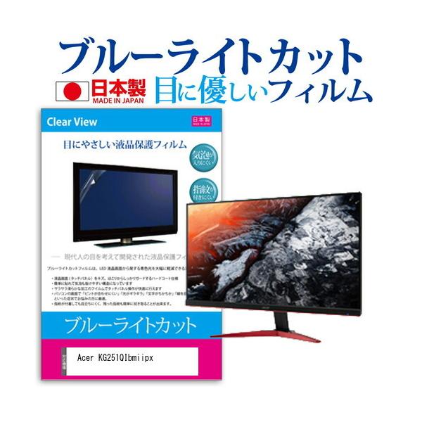 Acer KG251QIbmiipx  24.5�C���` �@��Ŏg���� �u���[���C�g�J�b�g ���˖h�~ �t�� �ی� �t�B���� �w��h�~ �C�A���X���H �݊��i