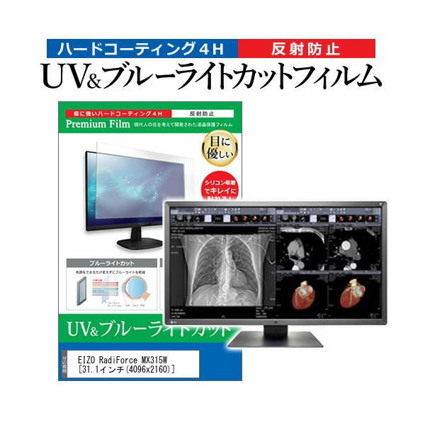 EIZO RadiForce MX315W  31.1�C���` �@��Ŏg���� �u���[���C�g�J�b�g ���˖h�~ �w��h�~ �t�� �ی� �t�B���� �݊��i