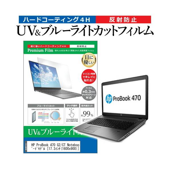 HP ProBook 470 G2/CT Notebook PC �X�^���_�[�h���f��  17.3�C���` �@��Ŏg���� �u���[���C�g�J�b�g ���˖h�~ �w��h�~ �t�� �ی� �t�B���� �݊��i