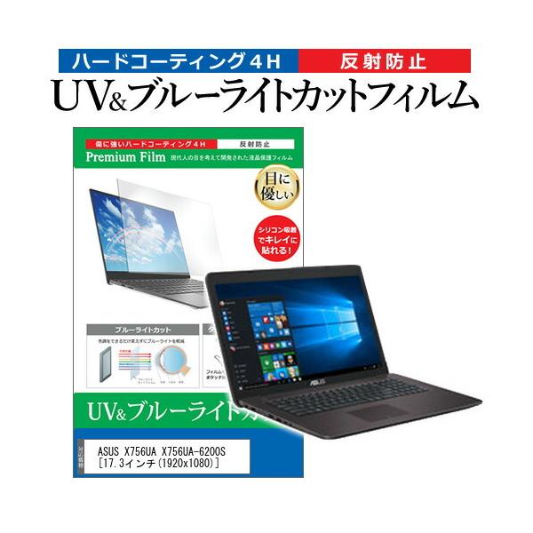 ASUS X756UA X756UA-6200S  17.3C` @Ŏg u[CgJbg ˖h~ wh~ t ی tB ݊i