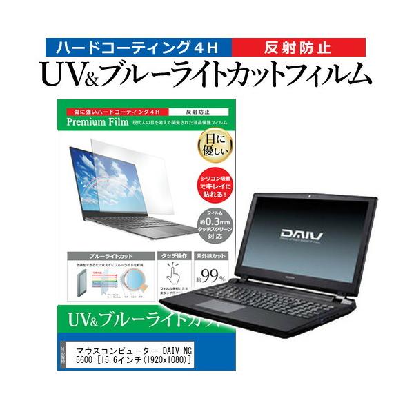 }EXRs[^[ DAIV-NG5600  15.6C` @Ŏg u[CgJbg ˖h~ wh~ t ی tB ݊i