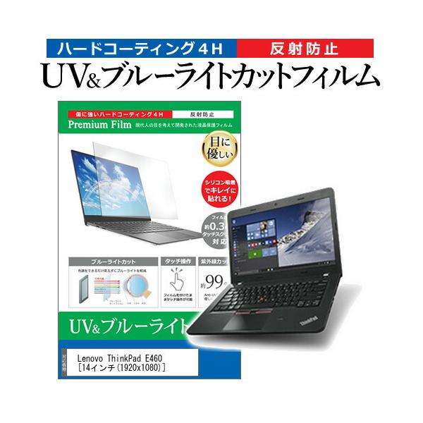 Lenovo ThinkPad E460  14C` @Ŏg u[CgJbg ˖h~ wh~ t ی tB ݊i