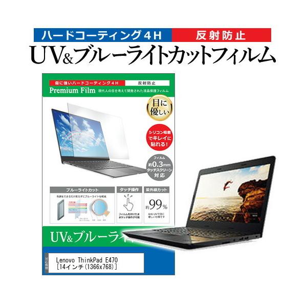 Lenovo ThinkPad E470  14C` @Ŏg u[CgJbg ˖h~ wh~ t ی tB ݊i