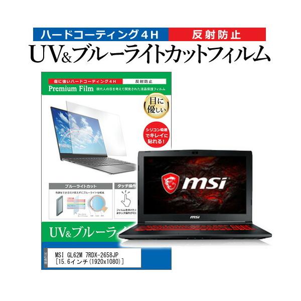 MSI GL62M 7RDX-2658JP  15.6�C���` �@��Ŏg���� �u���[���C�g�J�b�g ���˖h�~ �w��h�~ �t�� �ی� �t�B���� �݊��i