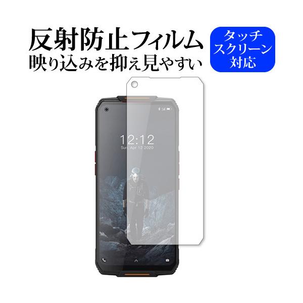 OUKITEL WP7 ��p ���˖h�~ �m���O���A �t�� �ی� �t�B���� �݊��i