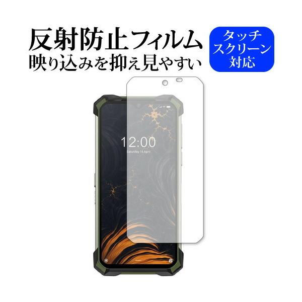 DOOGEE S88 Pro ��p ���˖h�~ �m���O���A �ی� �t�B���� ���[���֑������� �݊��i