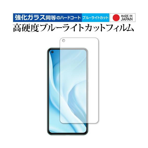 Xiaomi Mi 11 Lite 5G p KX   dx9H u[CgJbg NA یtB [֑ ݊i