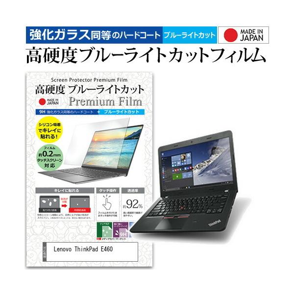 Lenovo ThinkPad E460  14C` @Ŏg  KXtB   dx9H u[CgJbg NA t ی tB ݊i