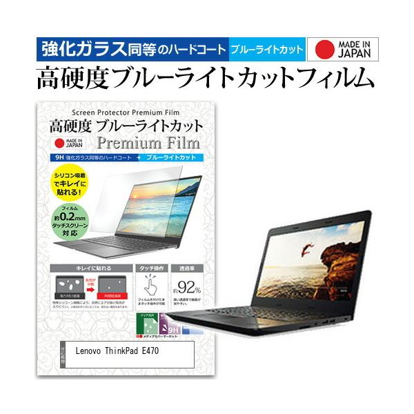 Lenovo ThinkPad E470  14C` @Ŏg  KXtB   dx9H u[CgJbg NA t ی tB ݊i