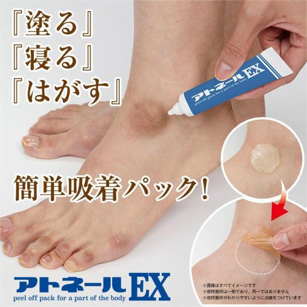 アトネールEX 15g 足の角質ケア クリーム パック 足 黒ずみ 角質 硬化