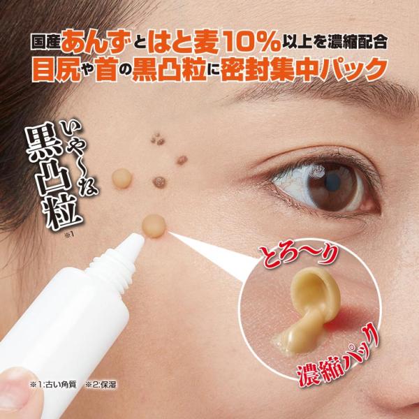 cho-kirei_putsu-tororin