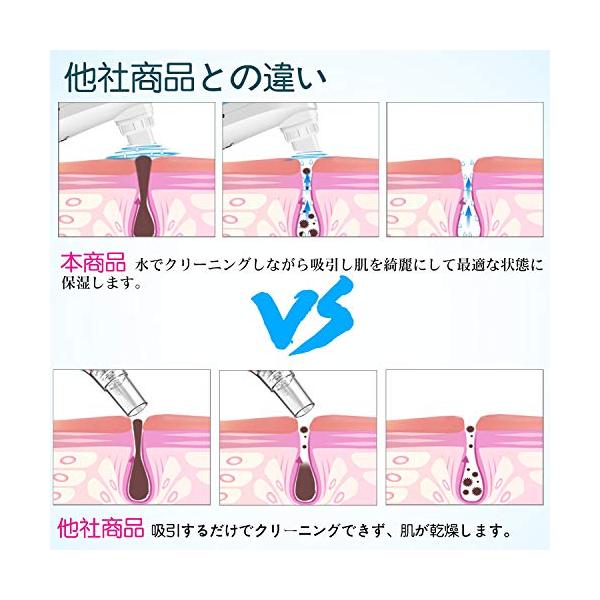 水槽分離水洗浄型吸引美顔器 保湿毛穴吸引器 青 吸引しながらクリーニング 黒ずみ ニキビ吸引 イチゴ鼻 角質 汚れ除去 青 Www Supersport Tn