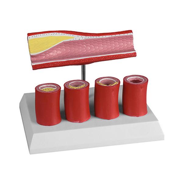 y񂹁zErler-Zimmer df G240 ͌^  Ō 