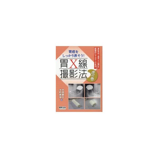 胃癌をしっかり表そう！ 胃X線撮影法　虎の巻?撮影手技を基本から応用まで段階的にマスターできる！ 胃癌をしっかり表そう！ 胃X線撮影法 虎の巻〜撮影手技を基本