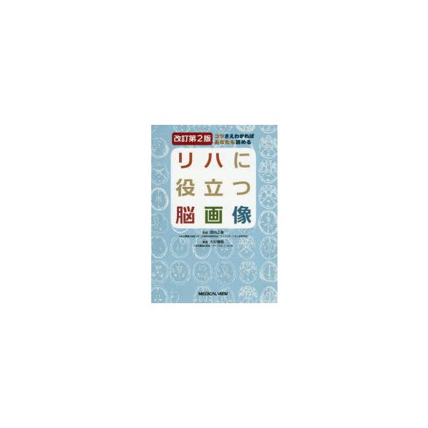 リハに役立つ脳画像 コツさえわかればあなたも読める 大村優慈/著 酒向