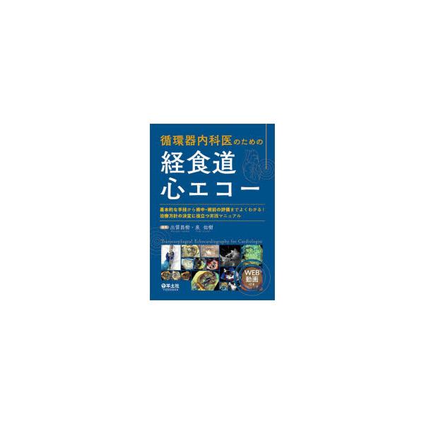 循環器内科医のための経食道心エコー 基本的な手技から術中・術前の