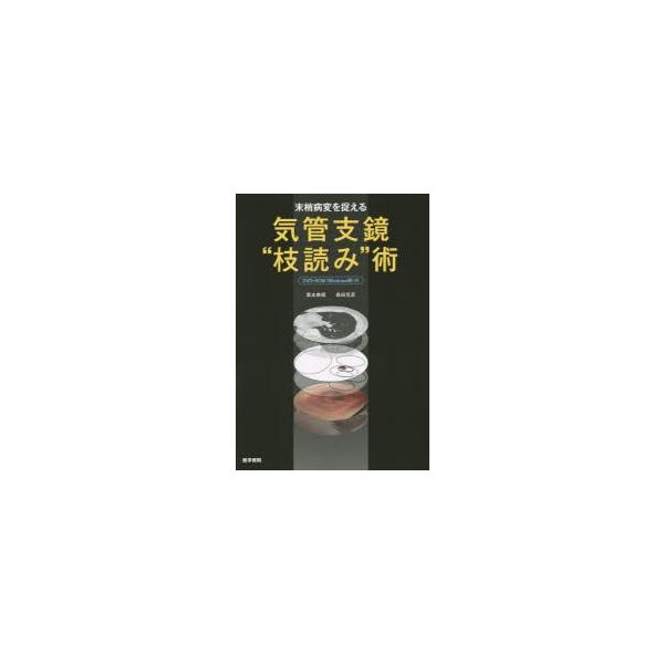 新品本 末梢病変を捉える気管支鏡 枝読み 術 栗本典昭 著 森田克彦 著 Buyee Buyee Japanese Proxy Service Buy From Japan Bot Online