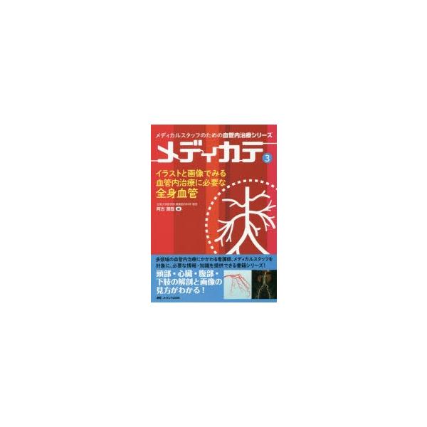 イラストと画像でみる血管内治療に必要な全身血管　阿古潤哉/編