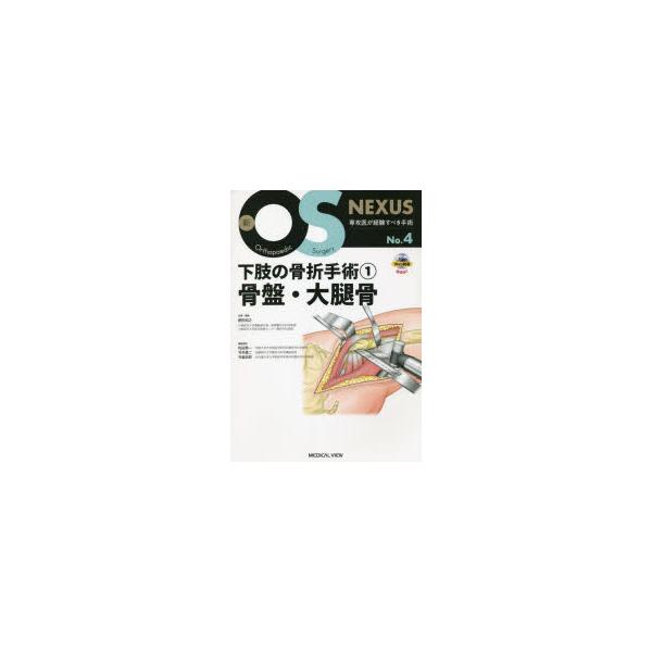 【裁断済】新OS NEXUS 4 下肢の骨折手術① 骨盤・大腿骨 新OS NEXUS 2022年No.4 (発売日2022年10月30日) | 雑誌/定期購読