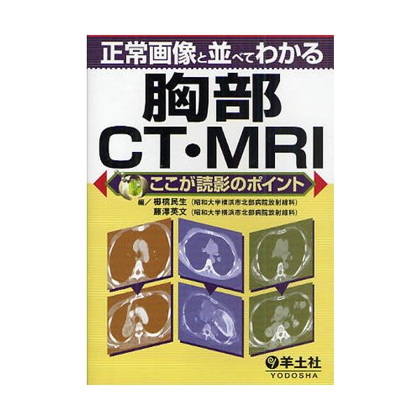 正常画像と並べてわかる胸部CT・MRI/櫛橋民生/藤澤英文