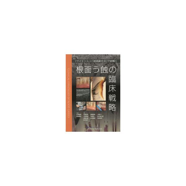 根面う蝕の臨床戦略 「サイエンス」×「超高齢社会」で紐解く