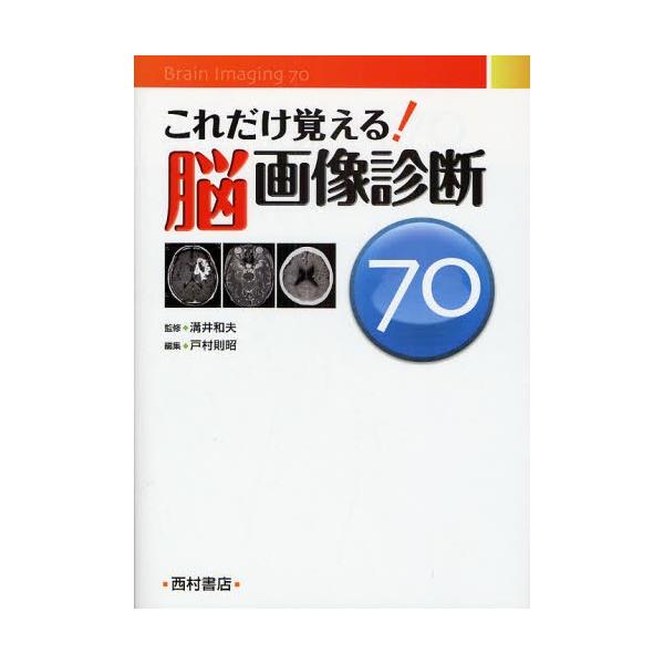 これだけ覚える!脳画像診断70