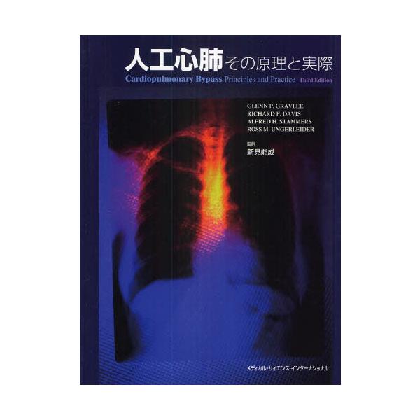 人工心肺 その原理と実際