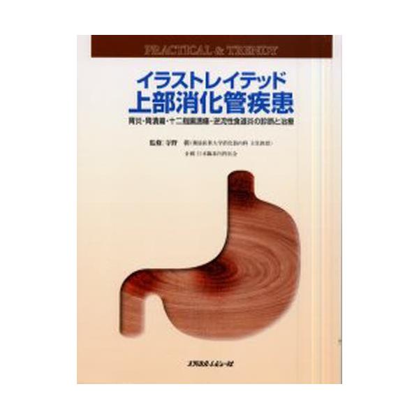 イラストレイテッド上部消化管疾患 胃炎 胃潰瘍 十二指腸潰瘍 逆流性食道炎の診断と治療 Practical Trendy Buyee Buyee 日本の通販商品 オークションの代理入札 代理購入