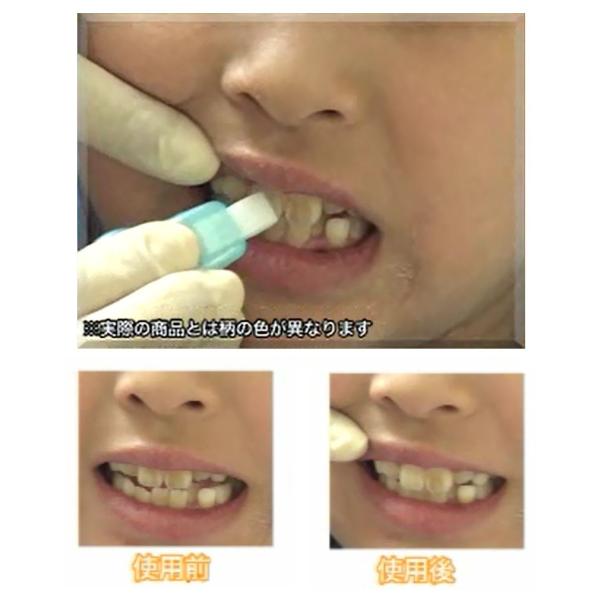 歯のピーリングスポンジ(DENTAL PEELING SPONGE) 3個入り × 3個セット 歯の着色汚れに!ぬらしてみがくだけ