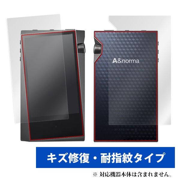 (������) �~���r�b�N�X OverLay Magic for A&amp;norma SR15 �w�\�ʁE�w�ʃZ�b�g�x