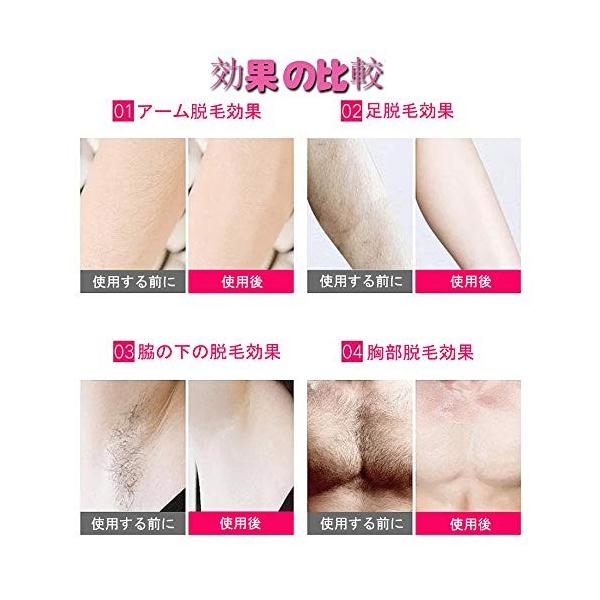 曲もしシットコム永久脱毛機家庭用 Abeanihos Jp