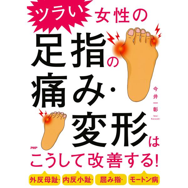 外反母趾・内反小趾・屈み指・モートン病 ツラい女性の足指の痛み・変形はこうして改善する! 電子書籍版 / 今井一彰(著)