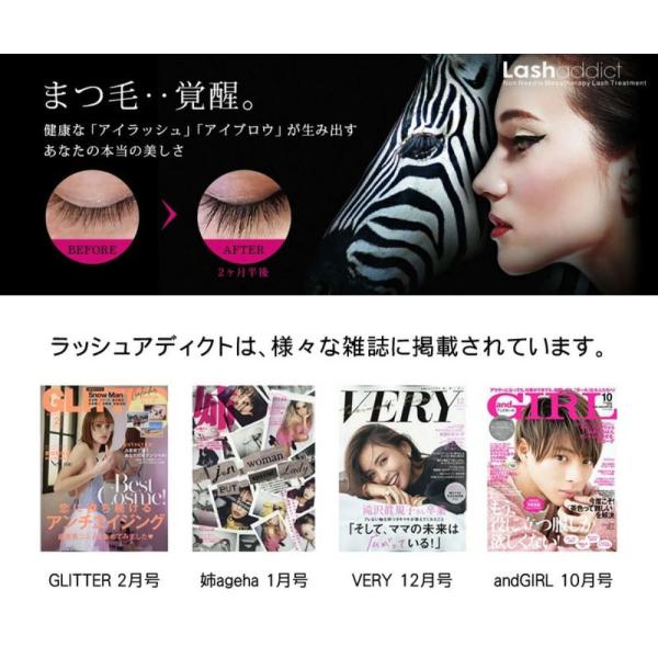 超特価激安 ラッシュアディクト アイラッシュ コンディショニングセラム 5ml 2本セット 正規品 Lashaddict まつ毛美容液 まつげ 美容液 人気 エクステ 睫毛 Sres Ca