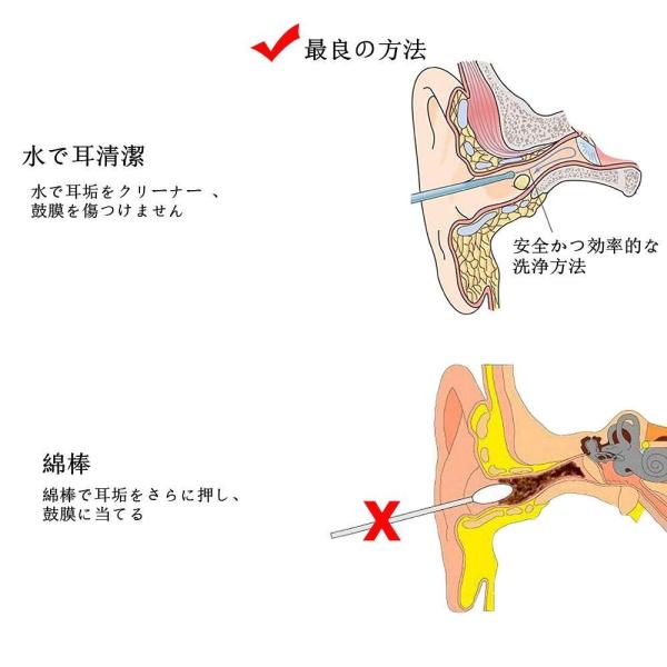 Hailicare 耳清潔 耳掃除 耳洗浄 耳垢清潔キット 耳のケア 耳のクリーニング イヤークリーナー耳クリーナー 耳かき 耳掻き 耳垢掃 Cybalinksolutions Com