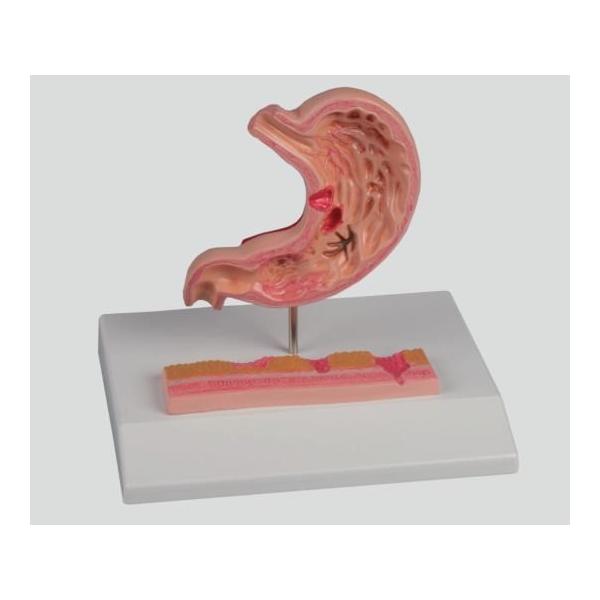 AY irX ݒᇃf X^ht K217 (8-8569-01)