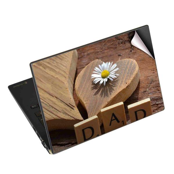 �m�[�g�p�\�R�� �X�L���V�[�� 17�C���`�܂őΉ� �ėp�X�e�b�J�[ 2���Z�b�g �A�N�Z�T���[ 030503 ���̓� �n�[�g �ؐ�
